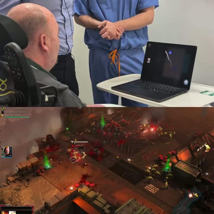 Первому пациенту Neuralink в Великобритании, Полу, парализованному из-за болезни двигательных нейронов, имплантировали мозг Первому пациенту Neuralink в Великобритании, Полу, парализованному из-за болезни двигательных нейронов, имплантировали мозг