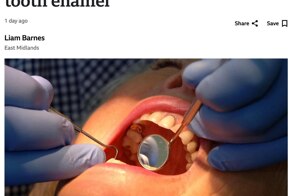 Учёные нашли способ практически полностью избавиться от кариеса — они разработали гель, который способен восстанавливать зубную эмаль
