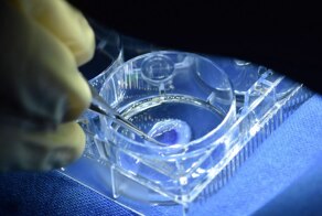 Израильские хирурги впервые в мире вернули зрение слепому, пересадив распечатанную на 3D-принтере роговицу глаза