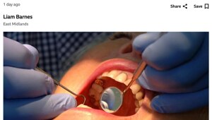 Учёные нашли способ практически полностью избавиться от кариеса — они разработали гель, который способен восстанавливать зубную эмаль