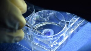 Израильские хирурги впервые в мире вернули зрение слепому, пересадив распечатанную на 3D-принтере роговицу глаза