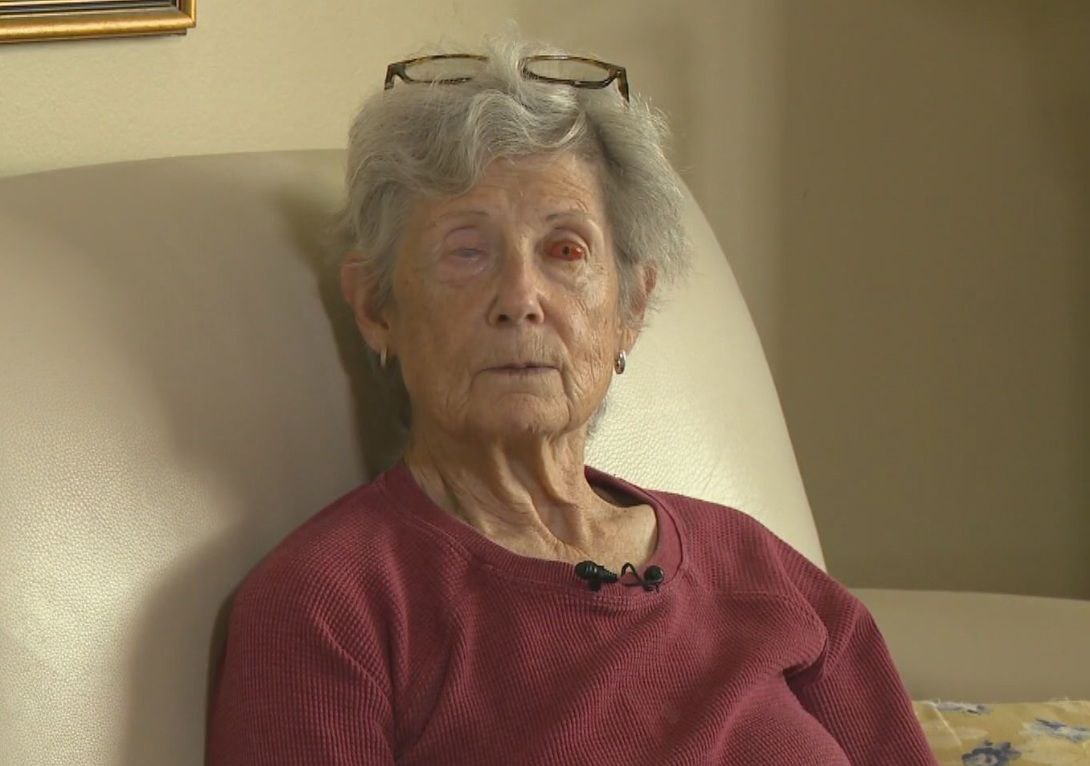 В Канаде женщине вставили зуб в глаз, чтобы она могла видеть